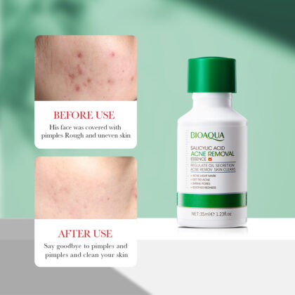 BIOAQUA Salicylic Acid Acne Removal Essence