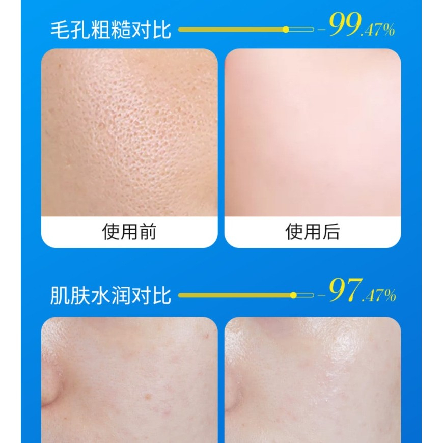 IMAGES Salicylic Acid Pore Cream - Image 4